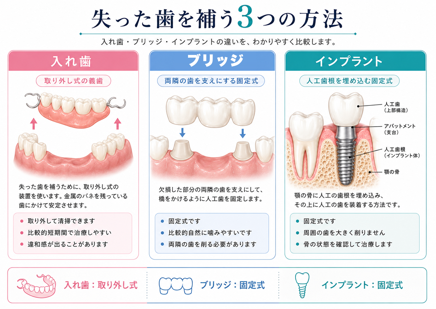 入れ歯・ブリッジ・インプラントの違いを比較した説明図