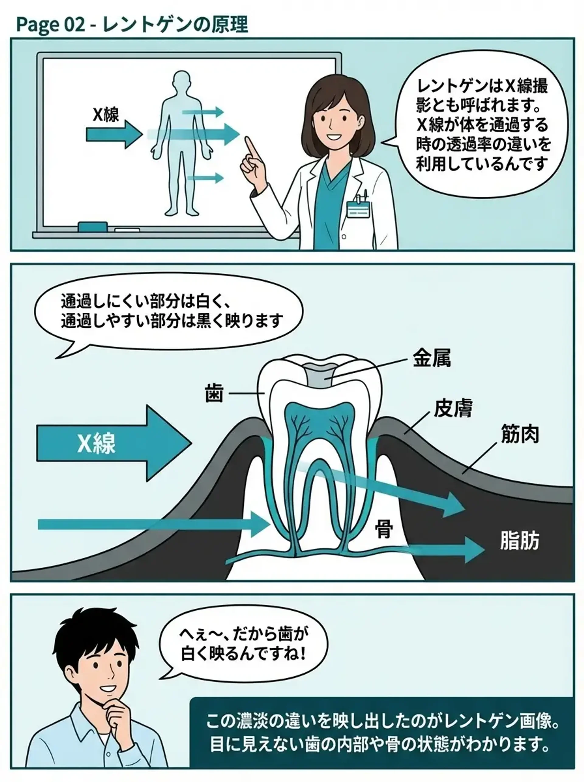 レントゲンの原理 - X線の透過率の違いで歯や骨が白く映る仕組みを図解