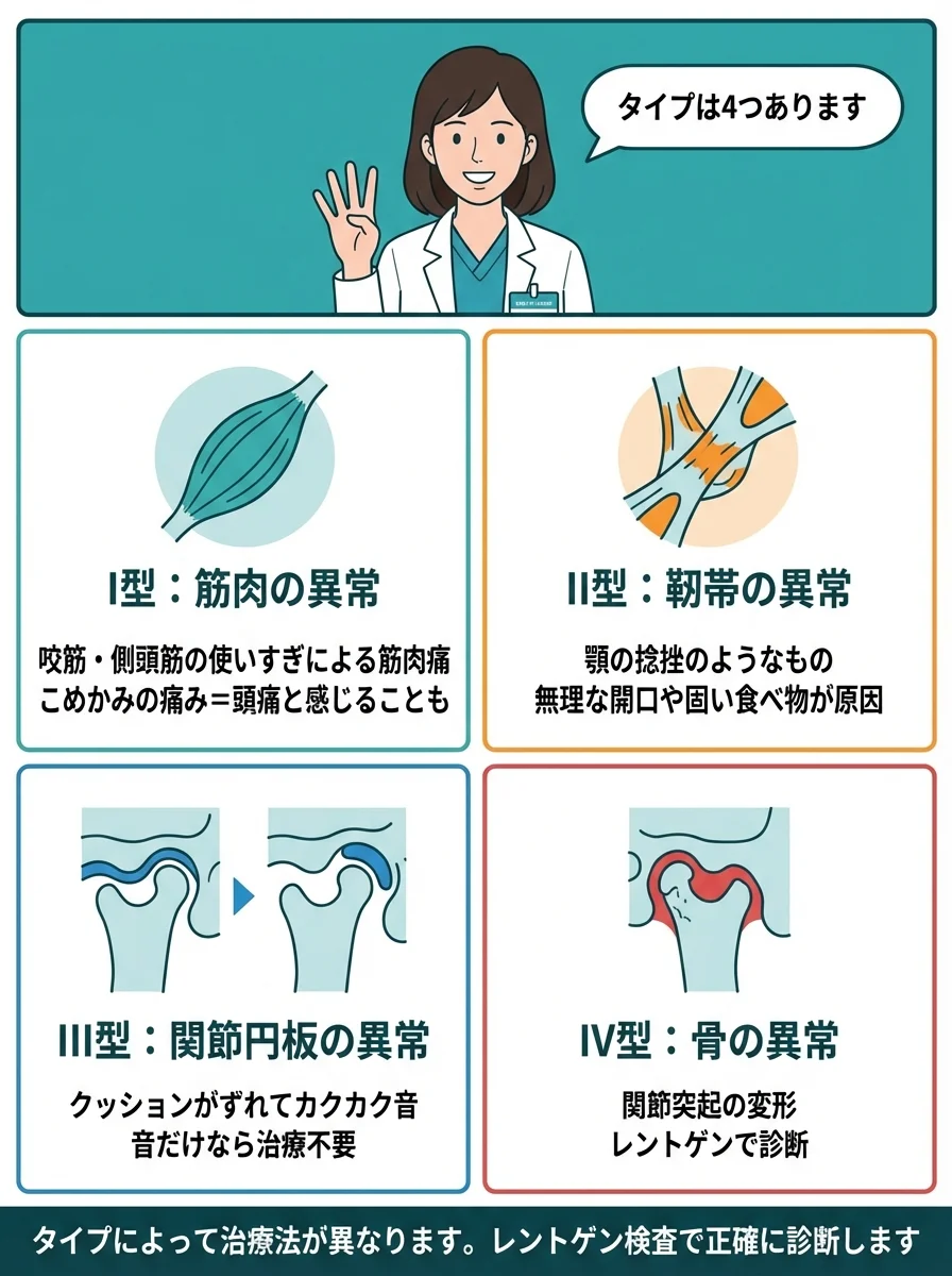 顎関節症の4つのタイプ分類マンガ - I型筋肉・II型靭帯・III型関節円板・IV型骨の異常