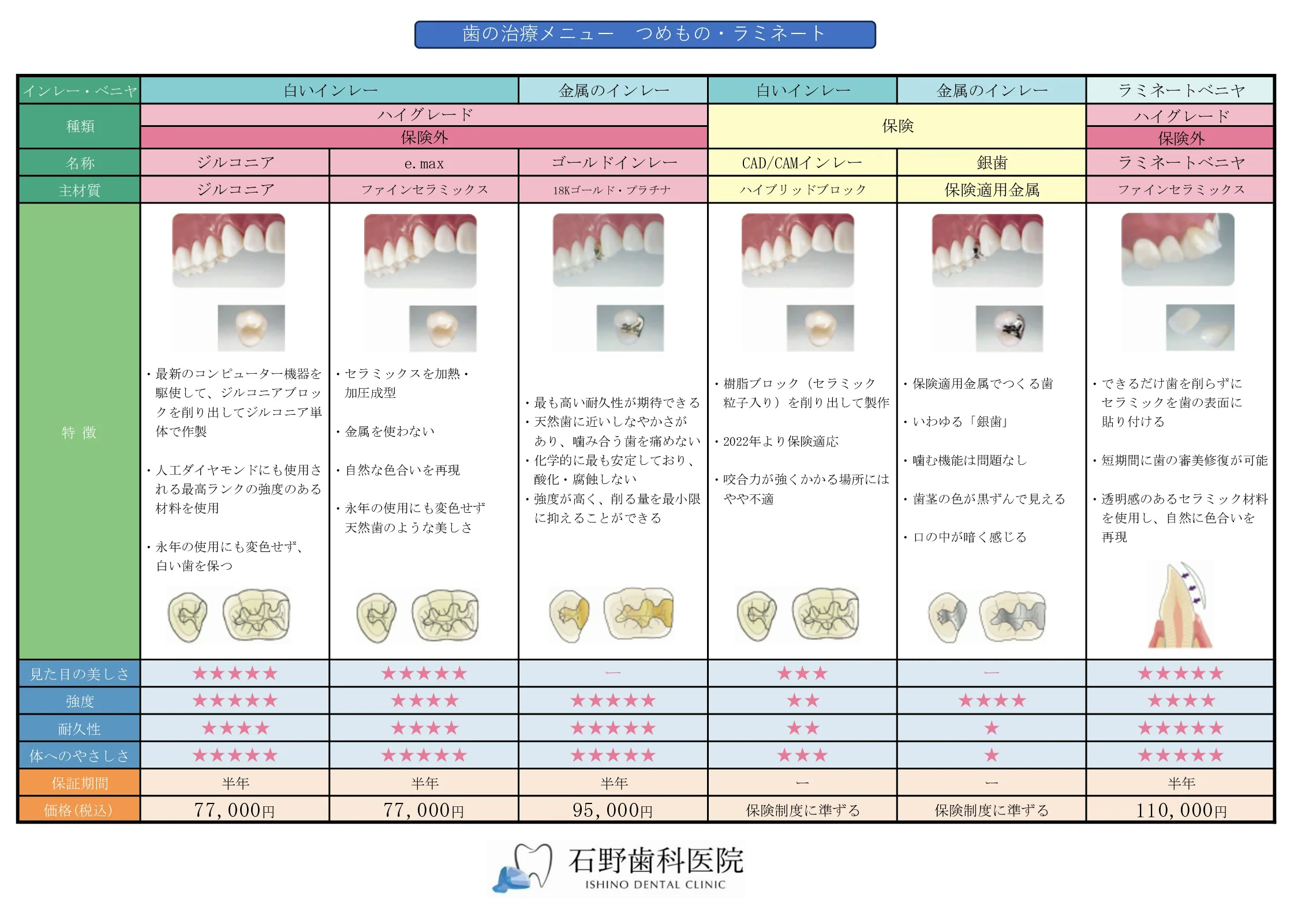 歯の治療メニュー_つめもの・ラミネート