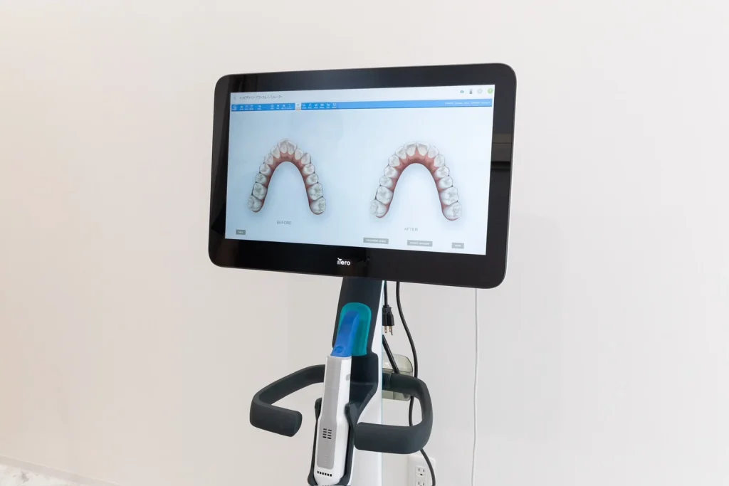 口腔内精密検査