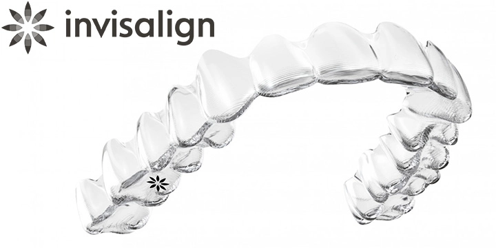 インビザライン・フル