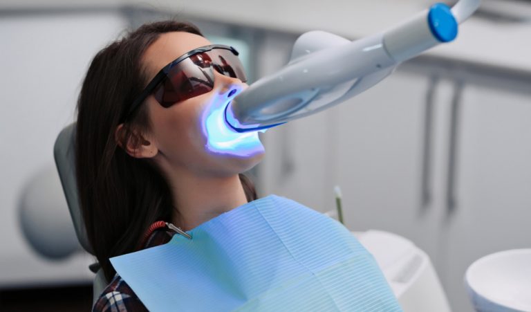 オフィスホワイトニング