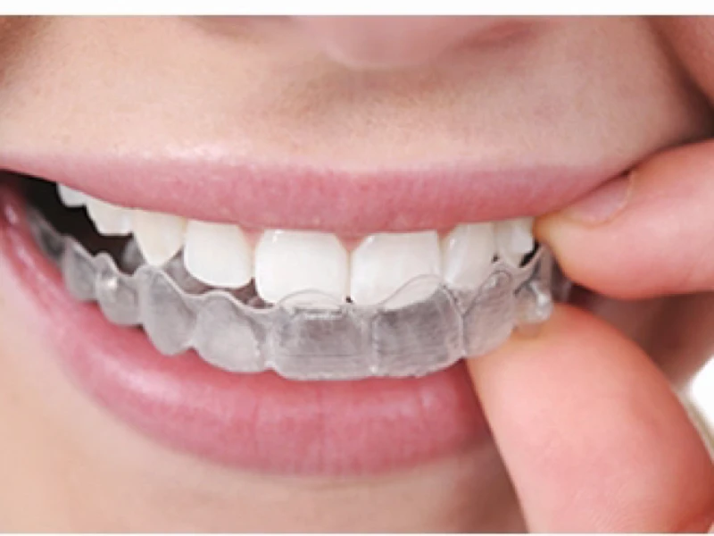 矯正治療のカウンセリング